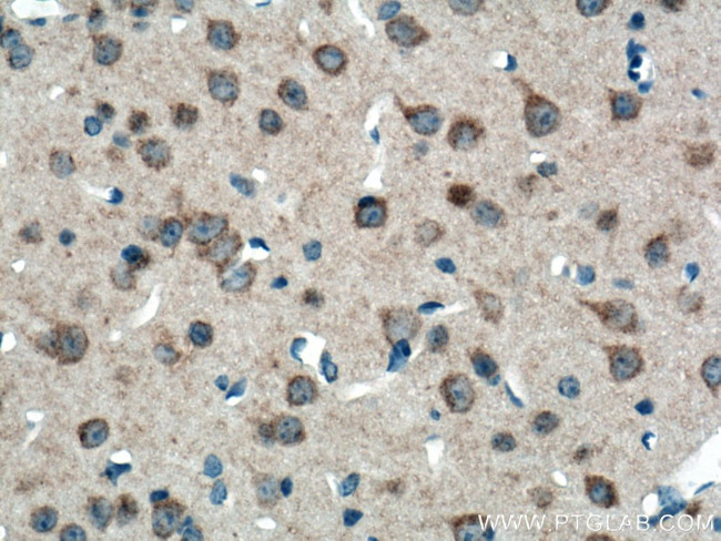 KIAA0652 Antibody in Immunohistochemistry (Paraffin) (IHC (P))