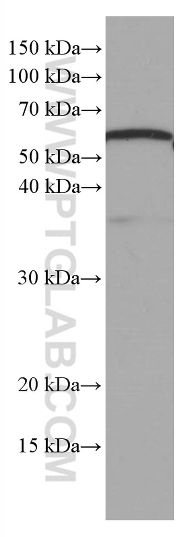 KIAA0652 Antibody in Western Blot (WB)