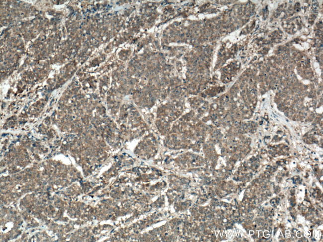 TPT1 Antibody in Immunohistochemistry (Paraffin) (IHC (P))