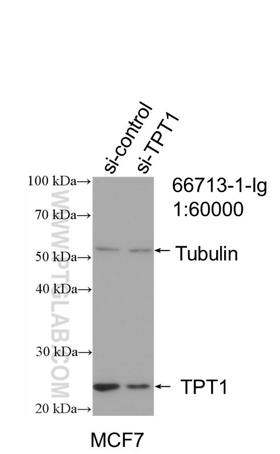 TPT1 Antibody in Western Blot (WB)