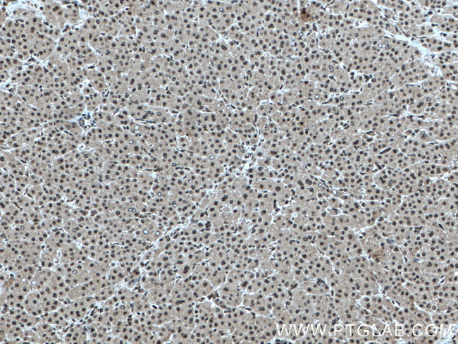 RBX1 Antibody in Immunohistochemistry (Paraffin) (IHC (P))