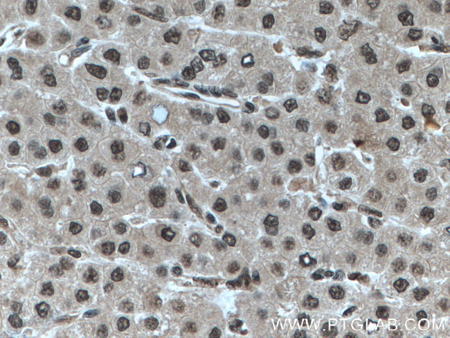 RBX1 Antibody in Immunohistochemistry (Paraffin) (IHC (P))