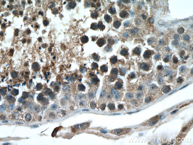 STK11 Antibody in Immunohistochemistry (Paraffin) (IHC (P))