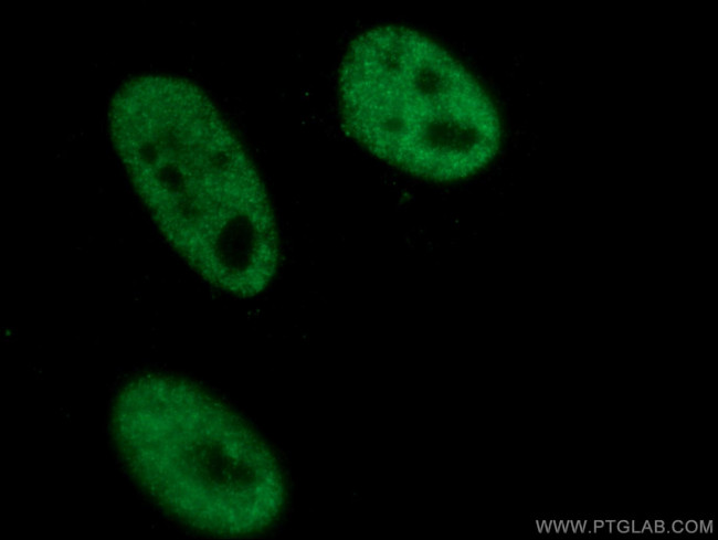 STK11 Antibody in Immunocytochemistry (ICC/IF)