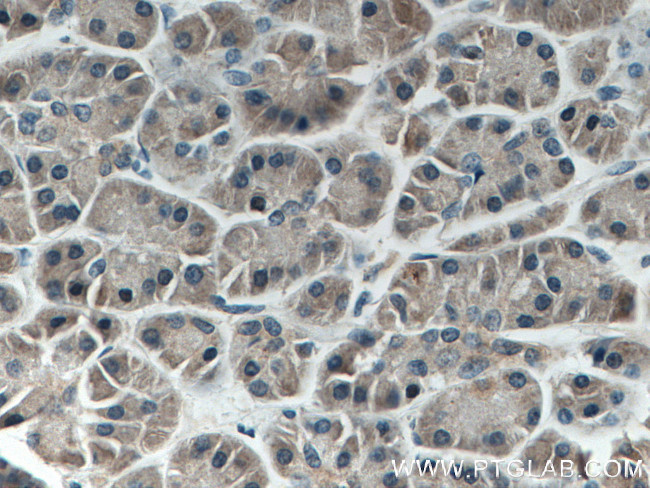 AGO2 Antibody in Immunohistochemistry (Paraffin) (IHC (P))