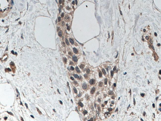 AGO2 Antibody in Immunohistochemistry (Paraffin) (IHC (P))