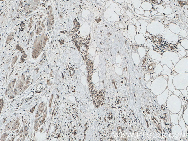 AGO2 Antibody in Immunohistochemistry (Paraffin) (IHC (P))