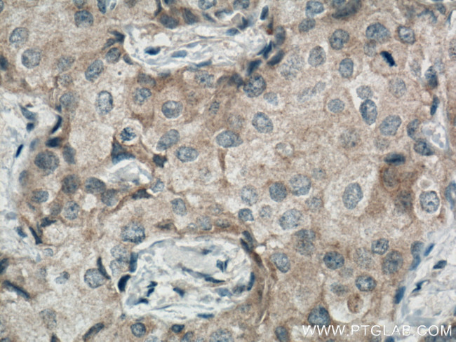 MRPS27 Antibody in Immunohistochemistry (Paraffin) (IHC (P))