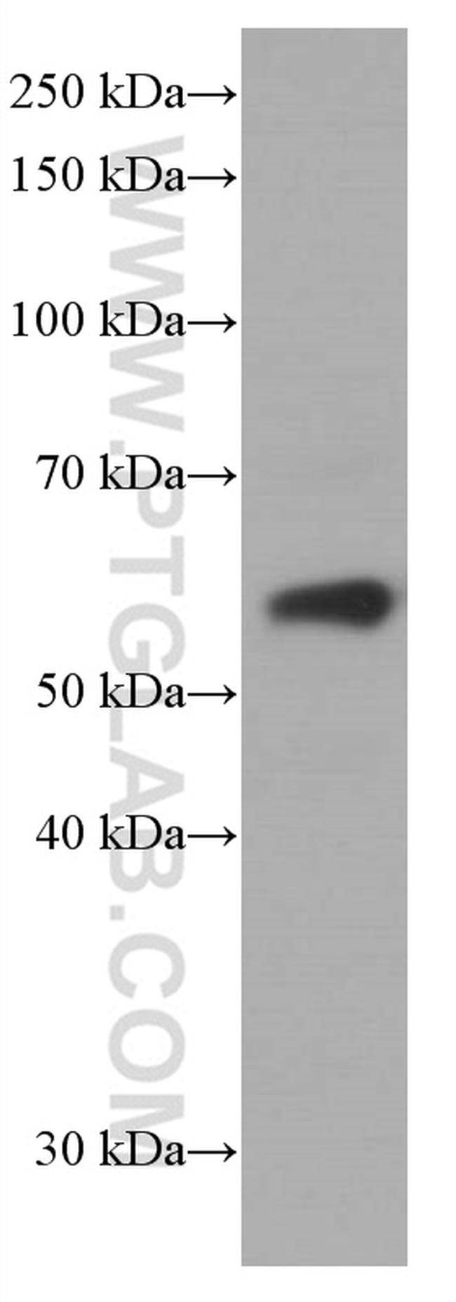 ARL13B Antibody in Western Blot (WB)