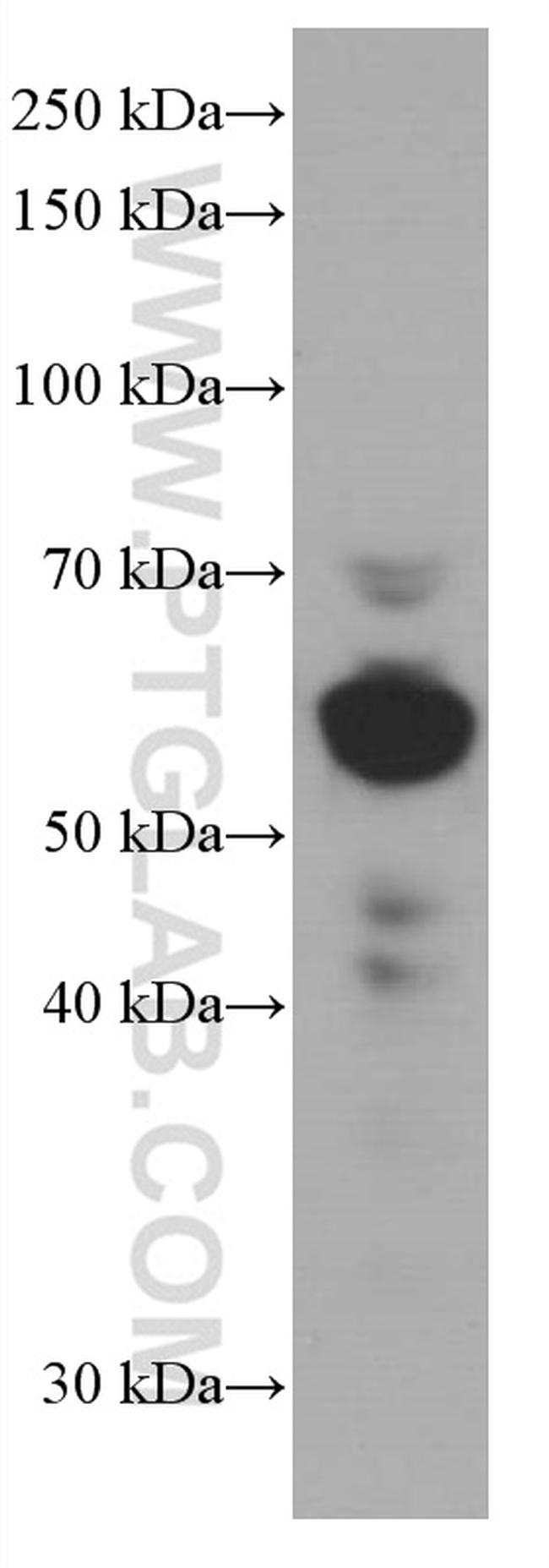 ARL13B Antibody in Western Blot (WB)