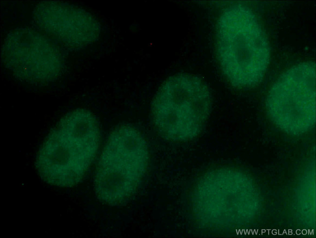 SRF Antibody in Immunocytochemistry (ICC/IF)