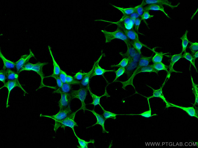 DKK3 Antibody in Immunocytochemistry (ICC/IF)