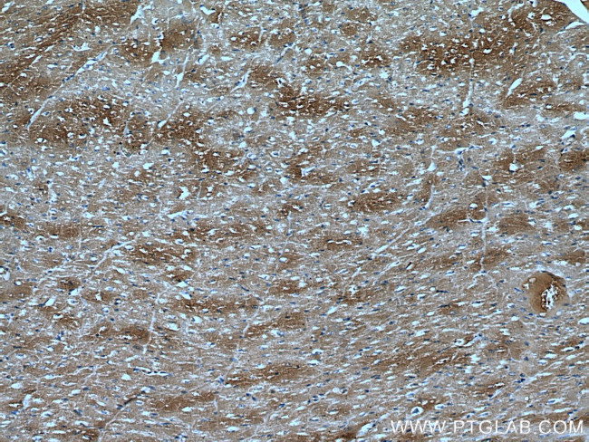 DKK3 Antibody in Immunohistochemistry (Paraffin) (IHC (P))