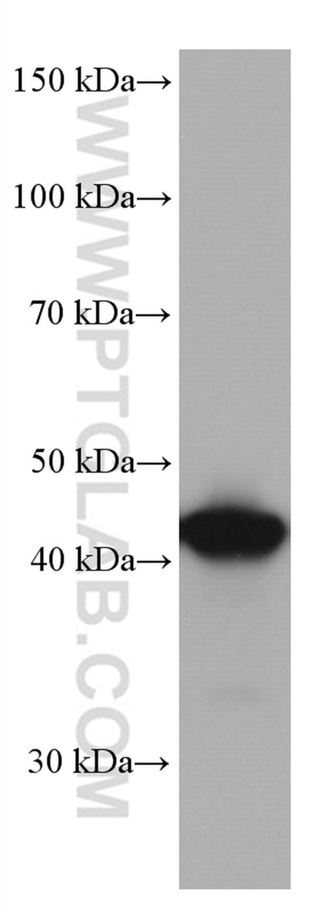 CKB Antibody in Western Blot (WB)