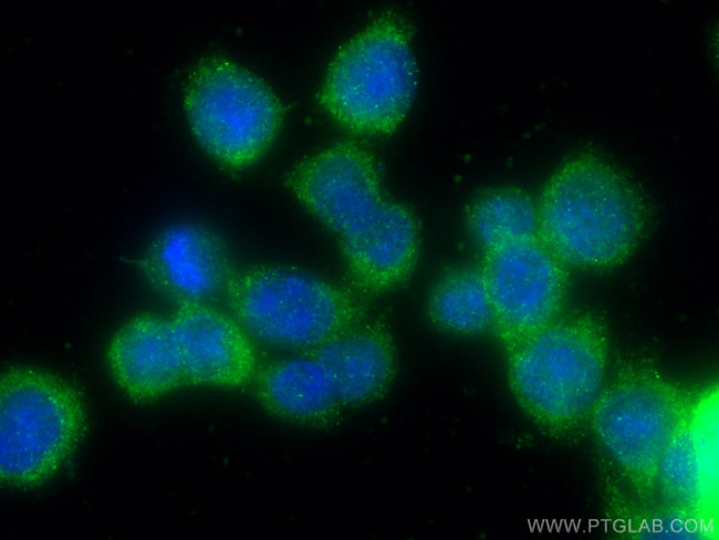 AGR2 Antibody in Immunocytochemistry (ICC/IF)