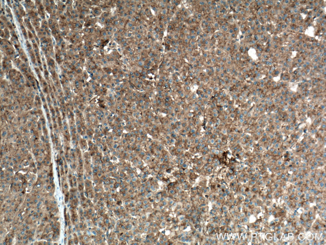 Apolipoprotein A II Antibody in Immunohistochemistry (Paraffin) (IHC (P))