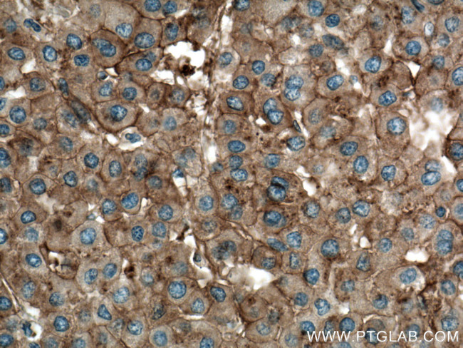 Apolipoprotein A II Antibody in Immunohistochemistry (Paraffin) (IHC (P))