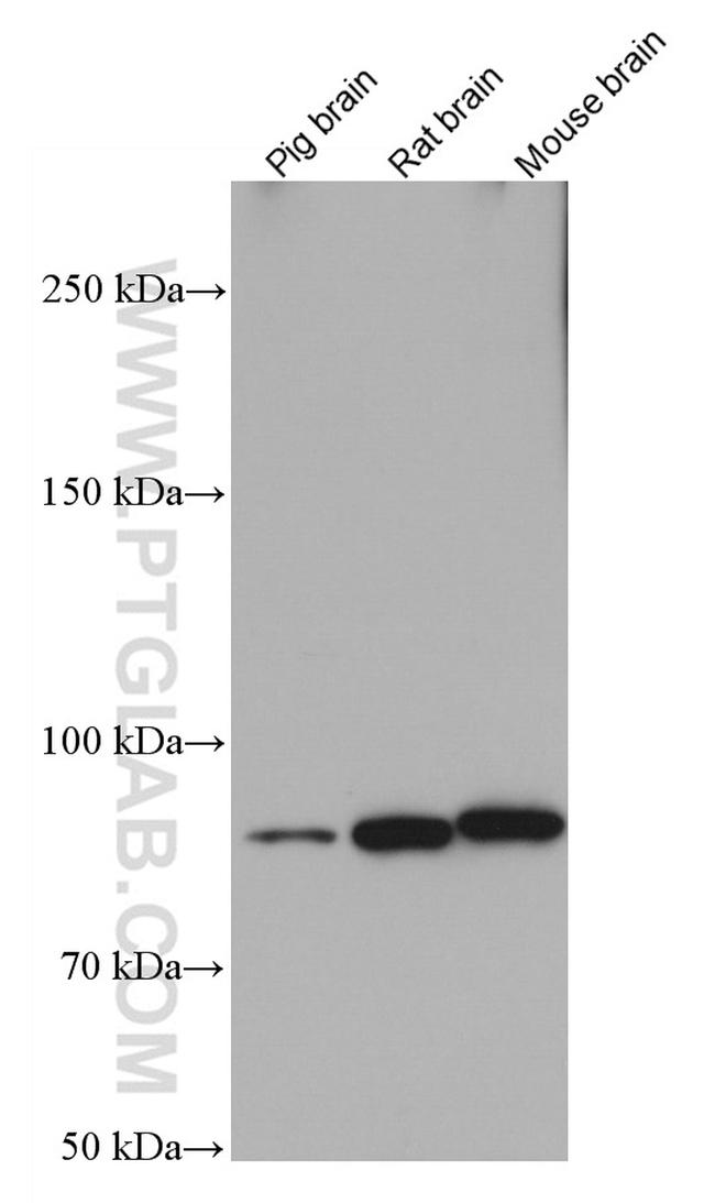 KCNQ2 Antibody in Western Blot (WB)