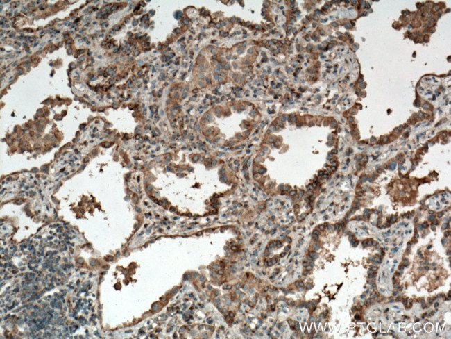 Syntaxin 16 Antibody in Immunohistochemistry (Paraffin) (IHC (P))