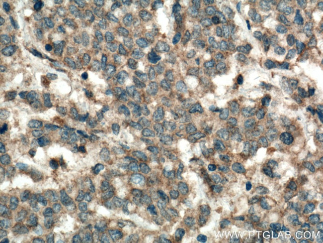 Syntaxin 16 Antibody in Immunohistochemistry (Paraffin) (IHC (P))