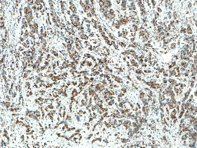 MFN1 Antibody in Immunohistochemistry (Paraffin) (IHC (P))