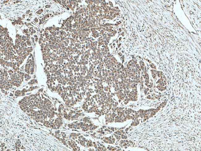 MFN1 Antibody in Immunohistochemistry (Paraffin) (IHC (P))