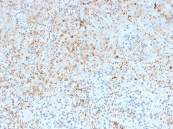 SPARC/Osteonectin Antibody in Immunohistochemistry (Paraffin) (IHC (P))