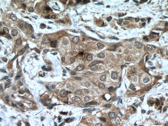 SOCS3 Antibody in Immunohistochemistry (Paraffin) (IHC (P))