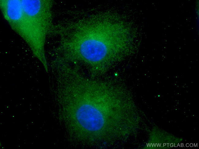 HPGD Antibody in Immunocytochemistry (ICC/IF)