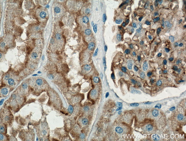 AQP1 Antibody in Immunohistochemistry (Paraffin) (IHC (P))