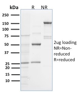 Spastin Antibody in SDS-PAGE (SDS-PAGE)