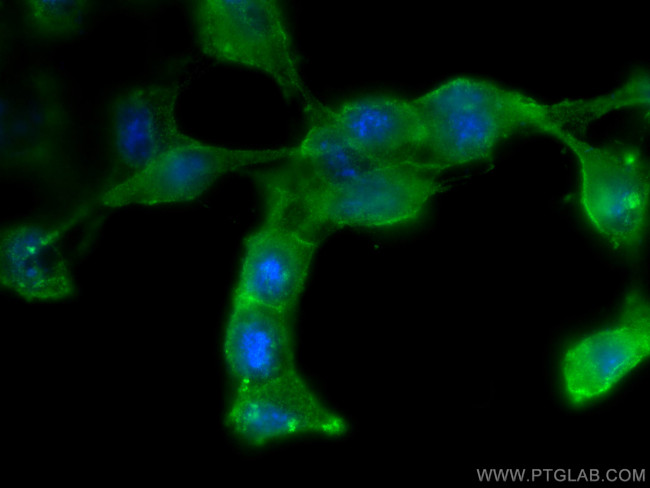 Phospho-RIPK1 (Ser161) Antibody in Immunocytochemistry (ICC/IF)