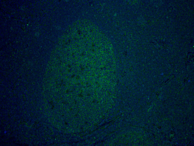 CD81 Antibody in Immunohistochemistry (Paraffin) (IHC (P))