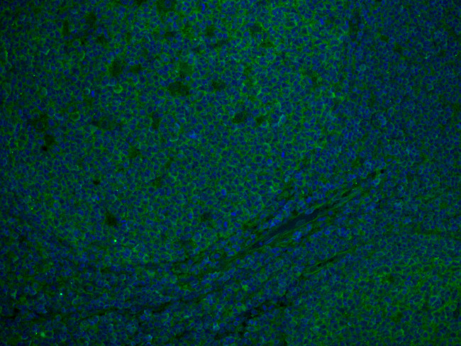 CD81 Antibody in Immunohistochemistry (Paraffin) (IHC (P))