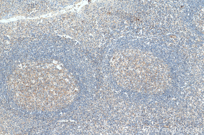 CD81 Antibody in Immunohistochemistry (Paraffin) (IHC (P))