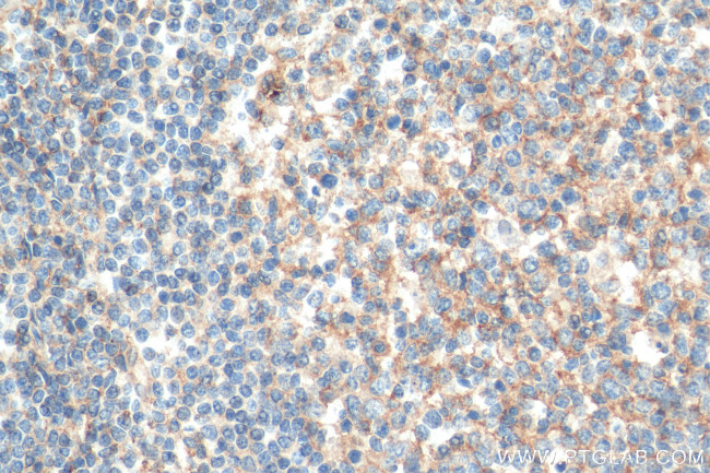 CD81 Antibody in Immunohistochemistry (Paraffin) (IHC (P))