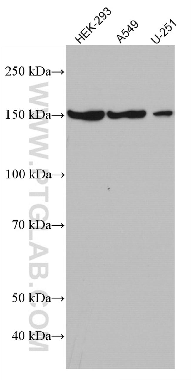 GLI1 Antibody in Western Blot (WB)