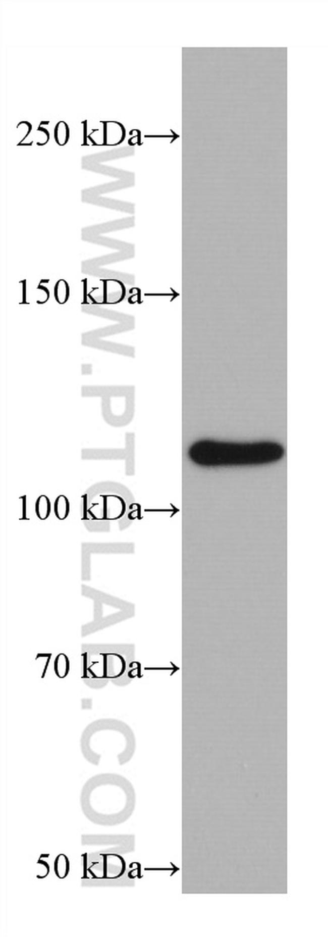 Integrin Alpha 6 Antibody in Western Blot (WB)