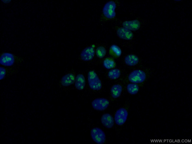 DDX21 Antibody in Immunocytochemistry (ICC/IF)