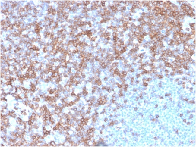 CD43 (T-Cell Marker) Antibody in Immunohistochemistry (Paraffin) (IHC (P))