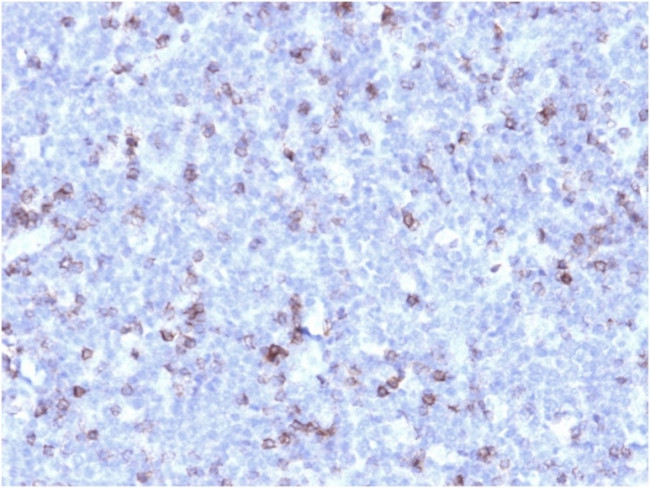 CD43 Antibody in Immunohistochemistry (Paraffin) (IHC (P))