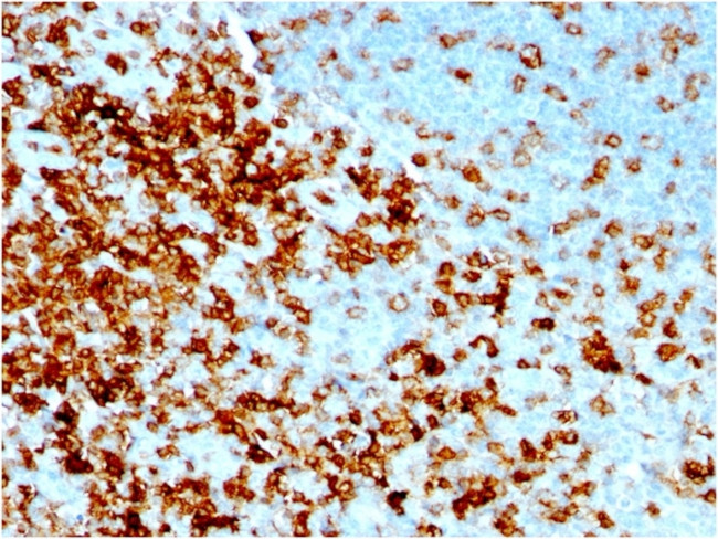 CD43 Antibody in Immunohistochemistry (Paraffin) (IHC (P))