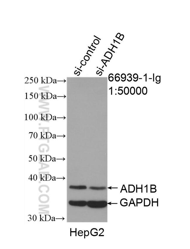 ADH1B Antibody in Western Blot (WB)