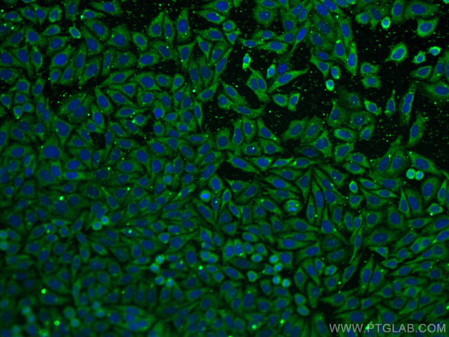 FGFR3 Antibody in Immunocytochemistry (ICC/IF)