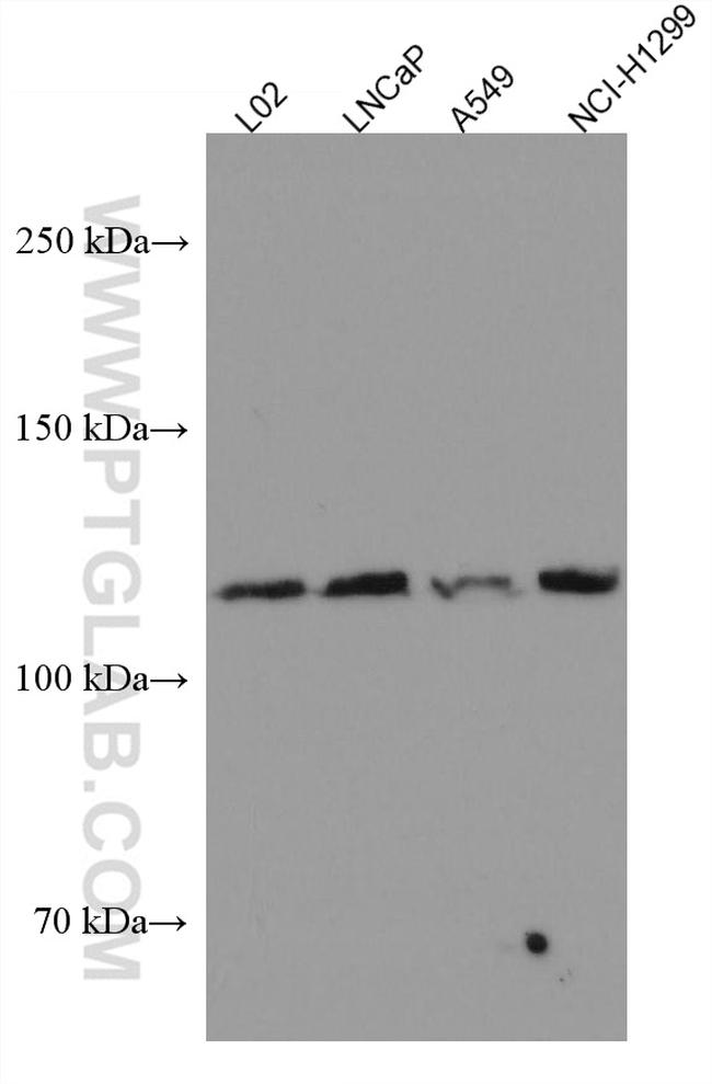 FGFR3 Antibody in Western Blot (WB)