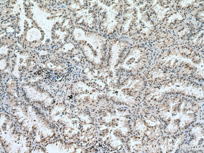 CUL1 Antibody in Immunohistochemistry (Paraffin) (IHC (P))