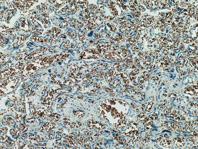 band 3/AE1 Antibody in Immunohistochemistry (Paraffin) (IHC (P))