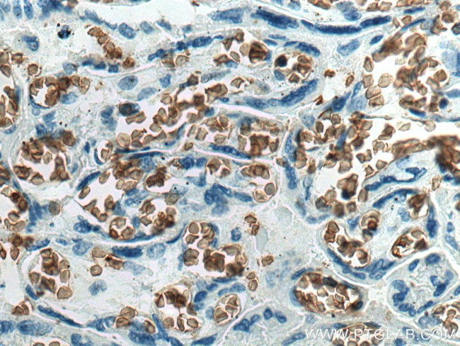 band 3/AE1 Antibody in Immunohistochemistry (Paraffin) (IHC (P))