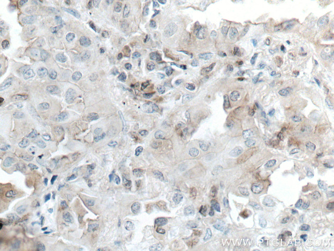 hIST1 Antibody in Immunohistochemistry (Paraffin) (IHC (P))