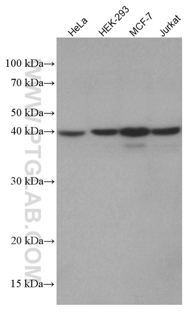 hIST1 Antibody in Western Blot (WB)